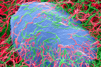 fibroblast cell