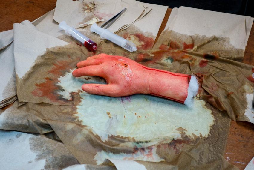 An exhibit detailing how stem cells can accelerate wound healing displays a realistic model.