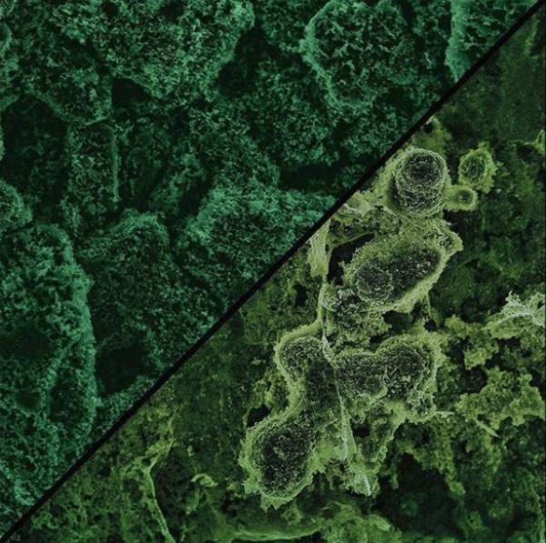 Where did all the fishes go?: â€œSuperhydrophobic aluminum created by coating coral like nanostructured 6061 (top left) and 7075 (bottom right) aluminum with silanes can be used to increase the efficiency of HVAC systems. We hope to see more fishes in coral reefs by creating technologies that will ultimately decrease our carbon footprint by reducing power consumption.â€ 