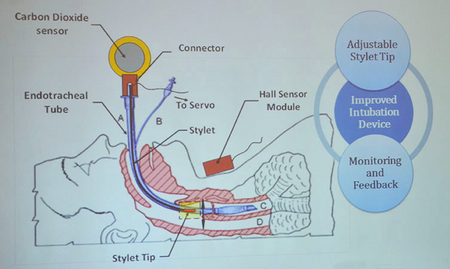 Illustration of the team's proposed intubation device.
