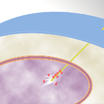 University of Illinois researchers developed a nanoneedle that releases quantum dots directly into the nucleus of a living cell when a small electrical charge is applied. Image courtesy Min-Feng Yu