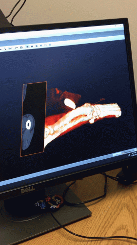 Click on the image to see how researchers generate a 3D surface scan of a bone.