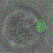 Twenty-four hour time-elapsed video shows melanoma tumor cells of mice squeezing and rotating an elastic microgel sphere filled with fluorescent nanoparticles.  Video courtesy Ning Wang