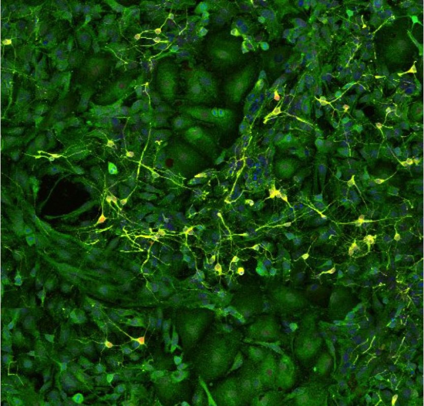 A cell culture containing neurons, stained in blue and yellow, surrounded by astrocytes, which are stained in green.