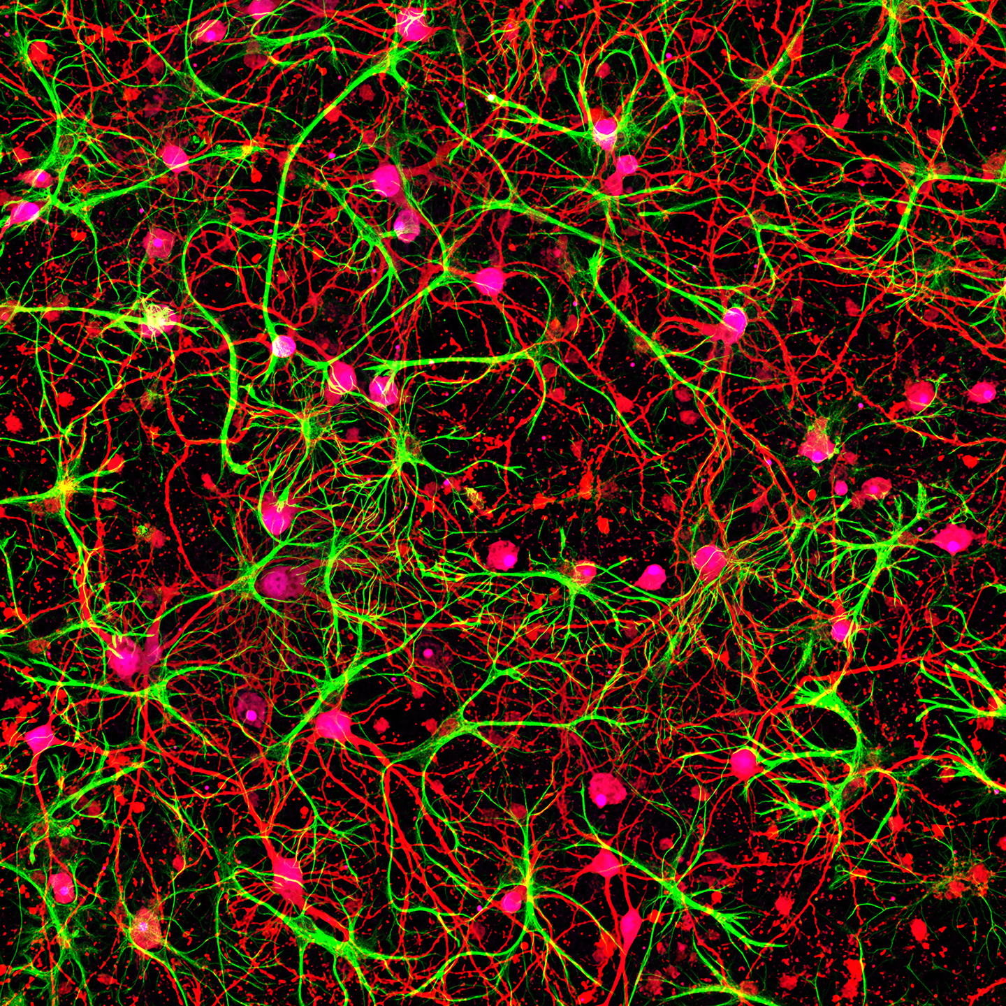 microscopic image of a network of rat hippocampal neurons